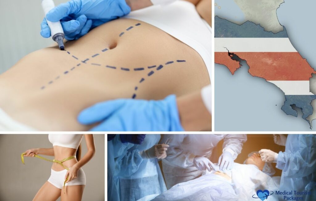 Collage featuring a marked torso for surgery, map of Costa Rica, woman measuring waist, and surgeons operating, with a "Medical Tourism Packages" logo—highlighting tummy tuck costs and Abdominoplasty in Costa Rica.