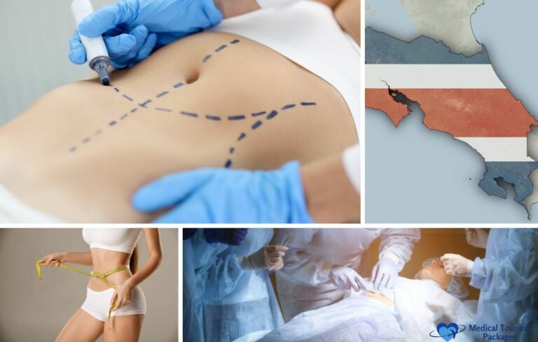 Collage featuring a marked torso for surgery, map of Costa Rica, woman measuring waist, and surgeons operating, with a "Medical Tourism Packages" logo—highlighting tummy tuck costs and Abdominoplasty in Costa Rica.