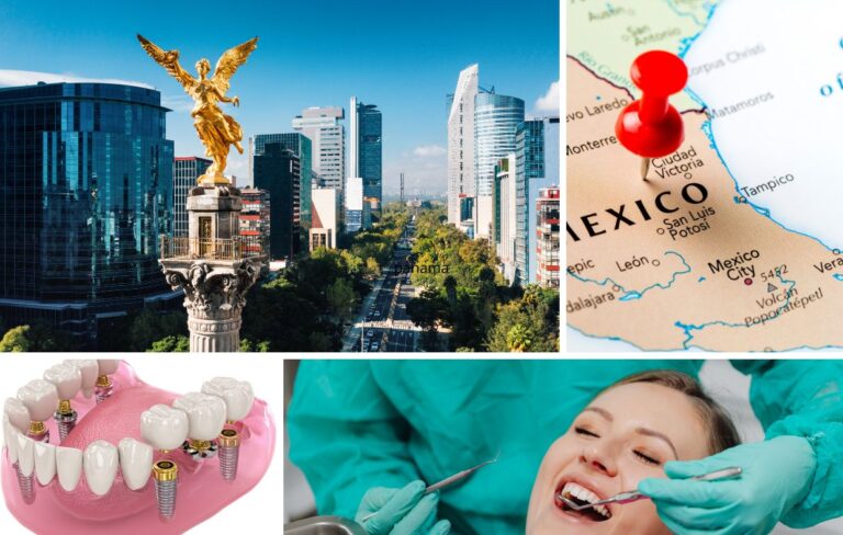 Collage of dental tourism in Mexico: city skyline, map with pin on Mexico, dental prosthetics model, and patient at dentist—highlighting Mexico dental implants and All-On-4 Dental Implants.