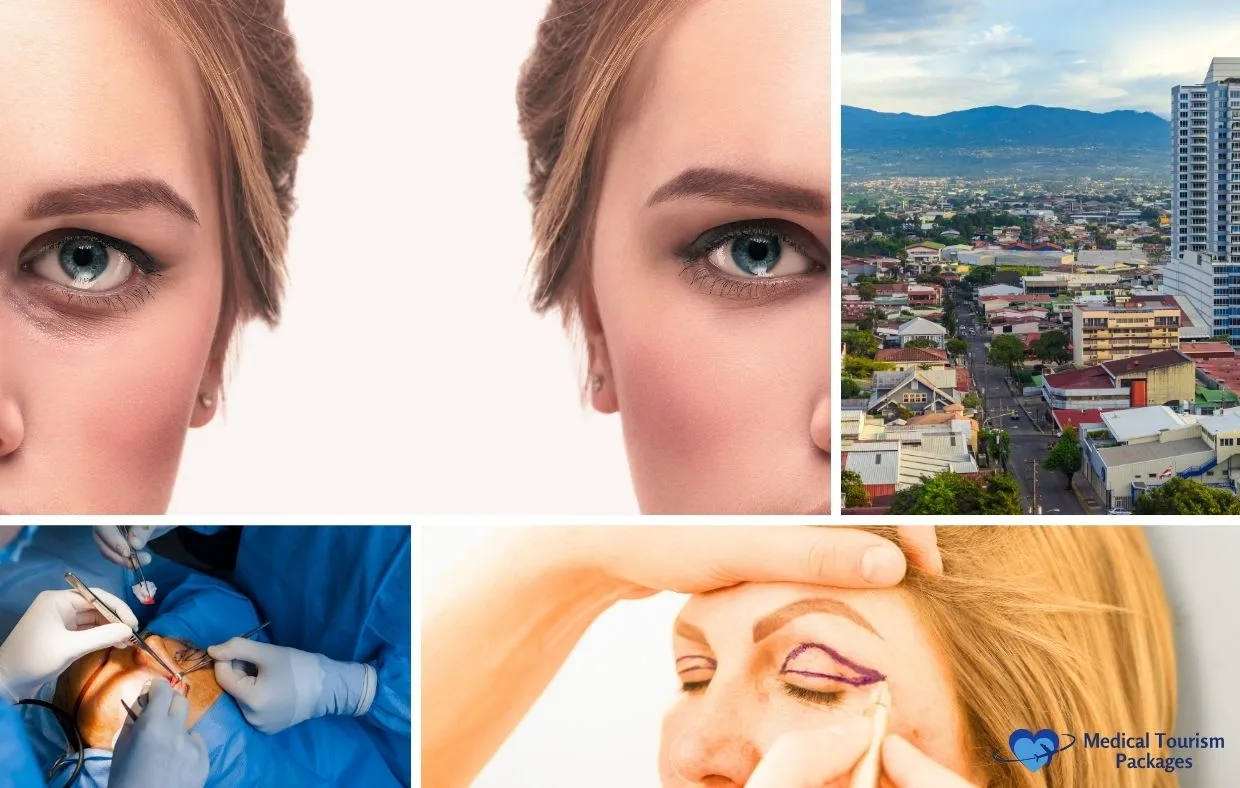 A collage showing a woman's eyes before and after an Eyelid Lift, a cityscape in Costa Rica, a surgical procedure, and pre-surgery markings on a woman's eyelid.
