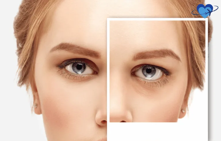 Primer plano del rostro de una mujer, dividido en dos secciones, que pone de relieve el efecto transformador de la blefaroplastia en los tonos y texturas de la piel.
