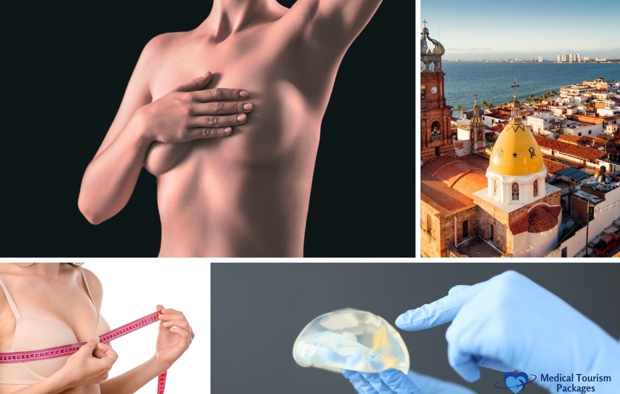 Collage of images showing a woman covering her chest, a coastal cityscape, a person measuring their bust, and a gloved hand holding a breast implant—highlighting Breast Augmentation Mexico and an essential recovery guide.