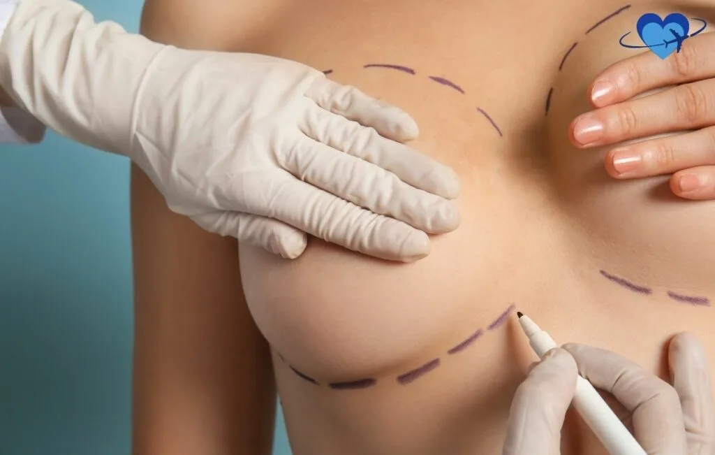 Clinical photograph showing gloved hands marking surgical guidelines on a patient's chest with purple surgical marker, demonstrating precise pre-operative planning for breast augmentation procedure against a teal medical background.