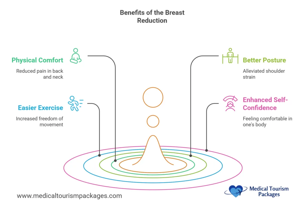 Circular infographic showing four key benefits of breast reduction surgery: physical comfort with green icon, easier exercise with blue icon, better posture with lime icon, and enhanced self-confidence with pink icon, each connected to descriptive text and arranged in concentric rings around a central point.