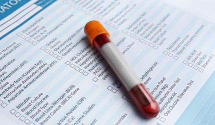 A blood sample vial rests on a medical laboratory test request form, highlighting the importance of preventative health with multiple test options and checkboxes designed for safeguarding vitality.