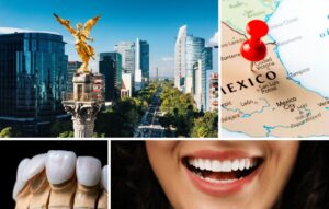 A collage showing Mexico City’s skyline, a map of Mexico with a red pin, dental veneers, and a close-up of a smiling person with white teeth.