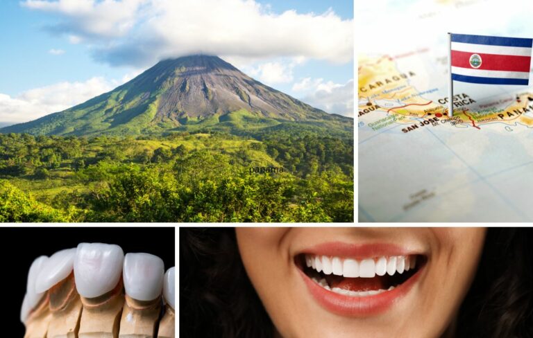 A collage featuring Arenal volcano, a Costa Rica map with a flag, dental crowns, and a person smiling with white teeth highlights the Dental Veneers Costa Rica treatment process.