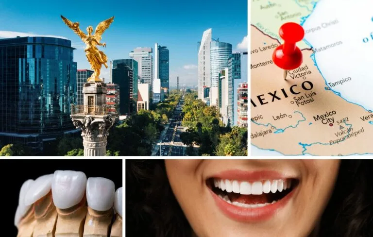 Collage showing Mexico City skyline, a map of Mexico with a red pin, dental veneers, and a person smiling with white teeth—perfect for illustrating the Dental Veneers Mexico treatment process or serving as a helpful cost guide.