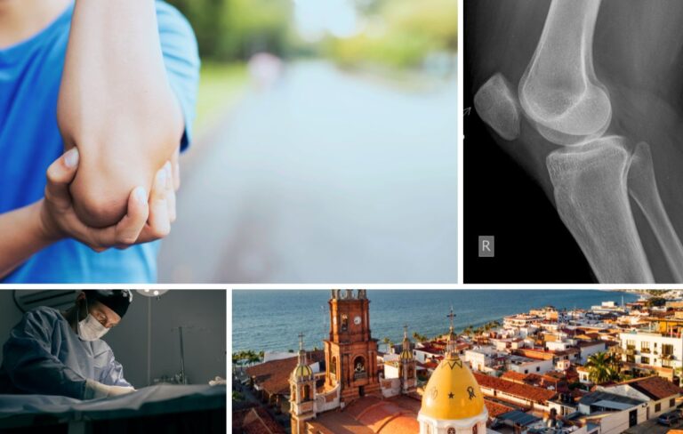 A collage featuring a person holding their elbow, a blurred outdoor scene, an X-ray of an elbow joint, a surgeon performing Elbow Arthroscopic Surgery, and a coastal Panama cityscape with a prominent church.
