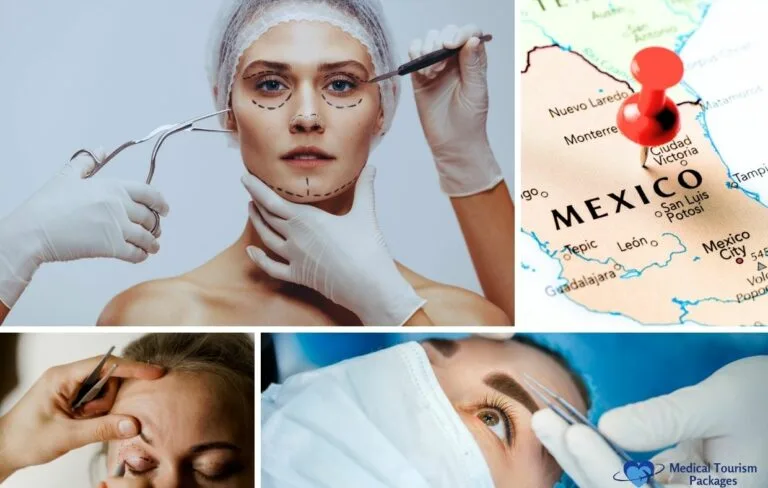 Collage showing a woman being marked for cosmetic surgery, close-ups of procedures, and a map of Mexico with a red pin—highlighting Blepharoplasty in Mexico and options for expert Blepharoplasty surgeons.