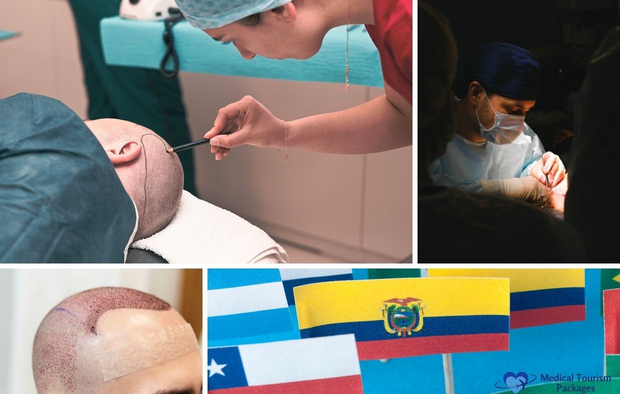 Collage showing hair transplant procedures, surgeons operating, a patient with a shaved scalp, international flags, and insights into Hair Implant Latin America with a cost guide.