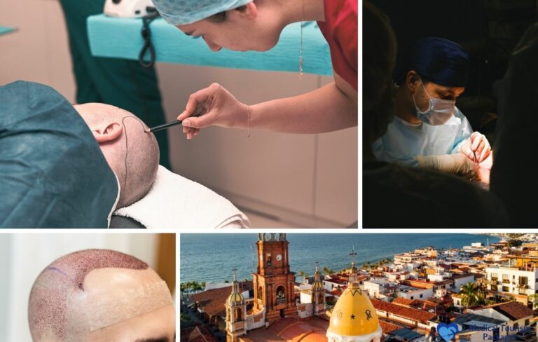 Collage showing stages of hair implant procedures in Mexico, with medical professionals performing surgeries, a patient with newly transplanted hair, and an aerial view of a coastal city.