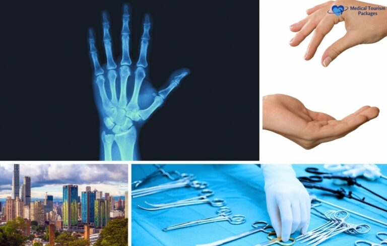 A collage shows a hand X-ray, two photos of hands, a cityscape, and a gloved hand arranging surgical instruments—reflecting the expertise of top hand surgeons and the landscape of hand surgery in Colombia.