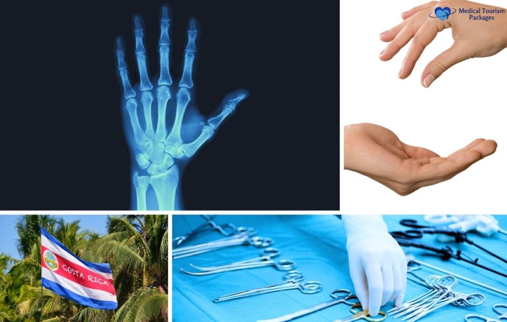 Collage showing a hand X-ray, two hands touching, the Costa Rican flag, and surgical instruments with a gloved hand, highlighting Medical Tourism and Hand Surgery Costa Rica.