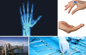 Un collage con una radiografía de una mano, dos manos que se tocan, un paisaje urbano, una mano enguantada con instrumentos quirúrgicos y el logotipo "Paquetes de turismo médico" destaca las clínicas de cirugía de mano y las opciones asequibles de cirugía de mano en Panamá.