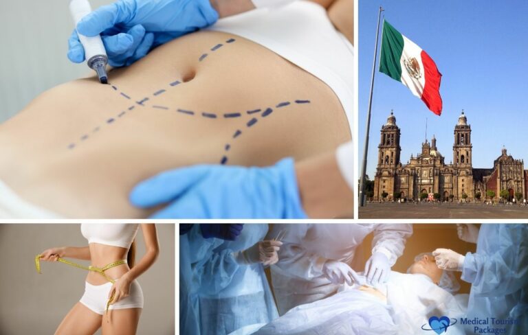 Collage showing a marked abdomen, a person measuring their waist, a surgery in progress, and the Mexico flag by a cathedral; highlights medical tourism for Liposuction in Mexico, including procedure information and cost.
