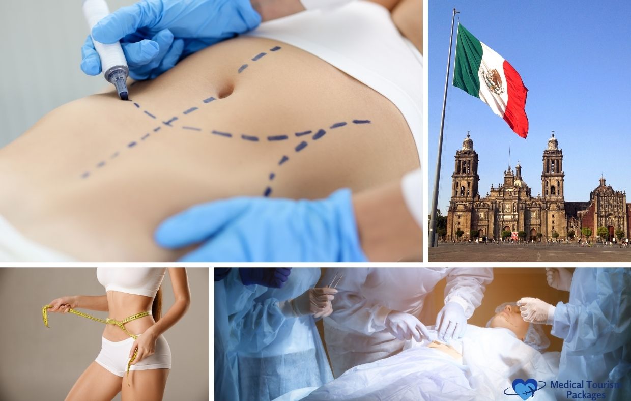 Collage showing a marked abdomen, a person measuring their waist, a surgery in progress, and the Mexico flag by a cathedral; highlights medical tourism for Liposuction in Mexico, including procedure information and cost.