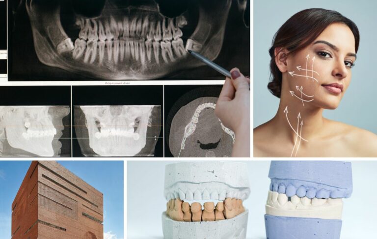 Un collage con radiografías dentales, una persona con líneas ilustrativas en el rostro, un edificio moderno de ladrillo y moldes dentales destaca a Cirugía Maxilofacial Colombia, ideal para quienes buscan atención especializada y las mejores clínicas como parte de su guía de turismo médico.