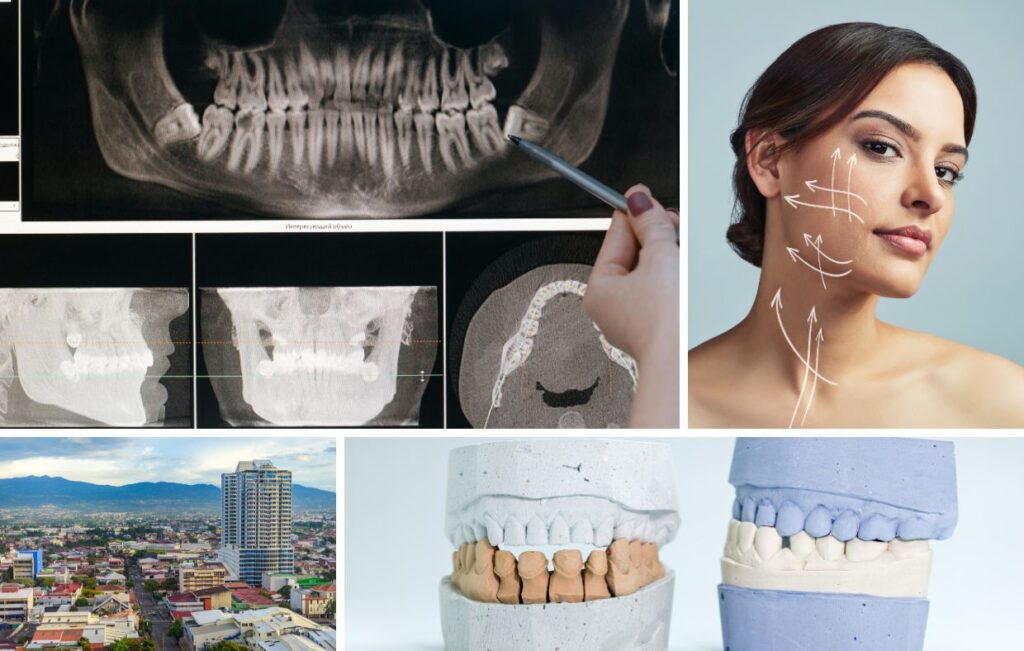 Un collage que muestra radiografías dentales, una mano señalando una tomografía, una mujer con marcas en la mandíbula, un paisaje urbano en Costa Rica y moldes dentales para tratamientos de ortodoncia en las mejores clínicas especializadas en cirugía maxilofacial.