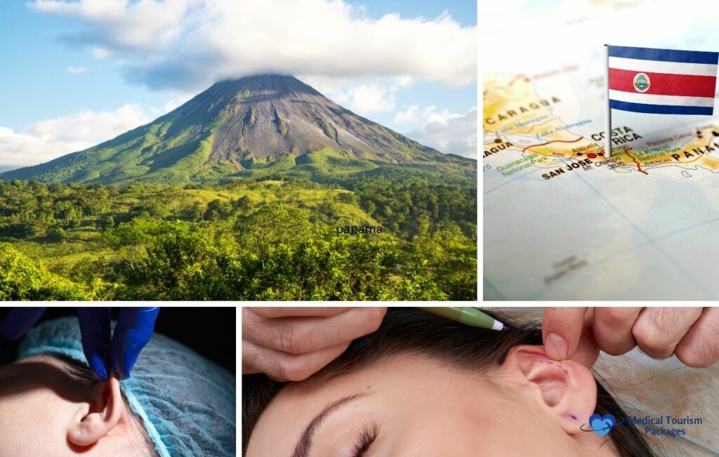 Un collage con el volcán Arenal, un mapa de Costa Rica y dos imágenes de intervenciones quirúrgicas en las orejas, como la otoplastia.