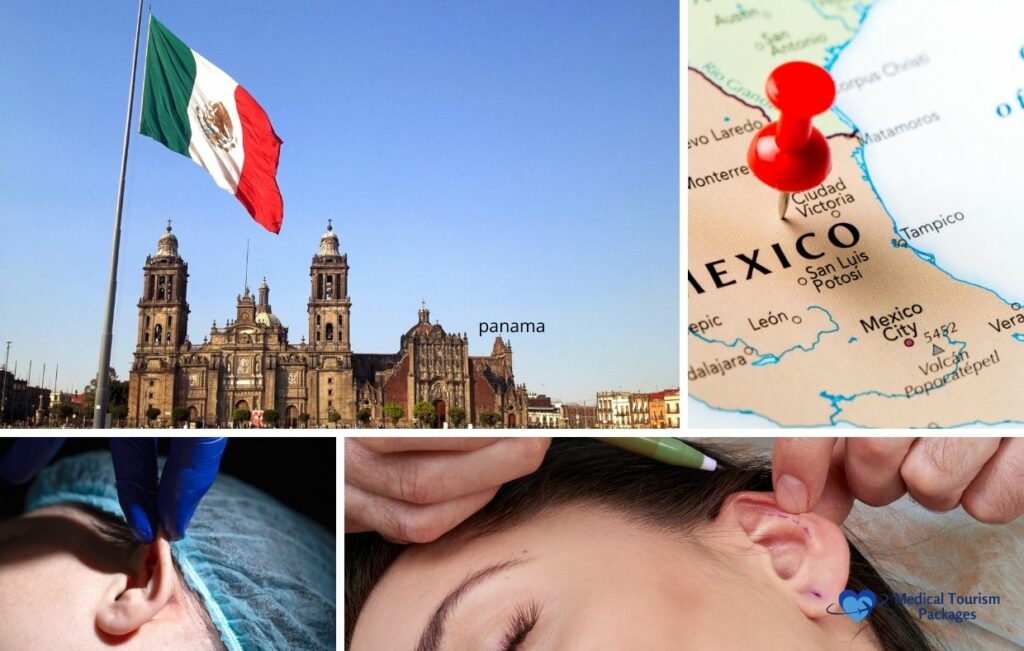 Collage showing the Mexican flag at a city square, a map of Mexico with a red pin, and close-ups of ear surgery procedures, highlighting why medical tourists choose Otoplasty in Mexico.