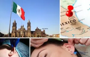 Collage que muestra la bandera mexicana en una plaza de la ciudad, un mapa de México con un marcador rojo y primeros planos de procedimientos de cirugía de orejas, destacando por qué los turistas médicos eligen la otoplastia en México.
