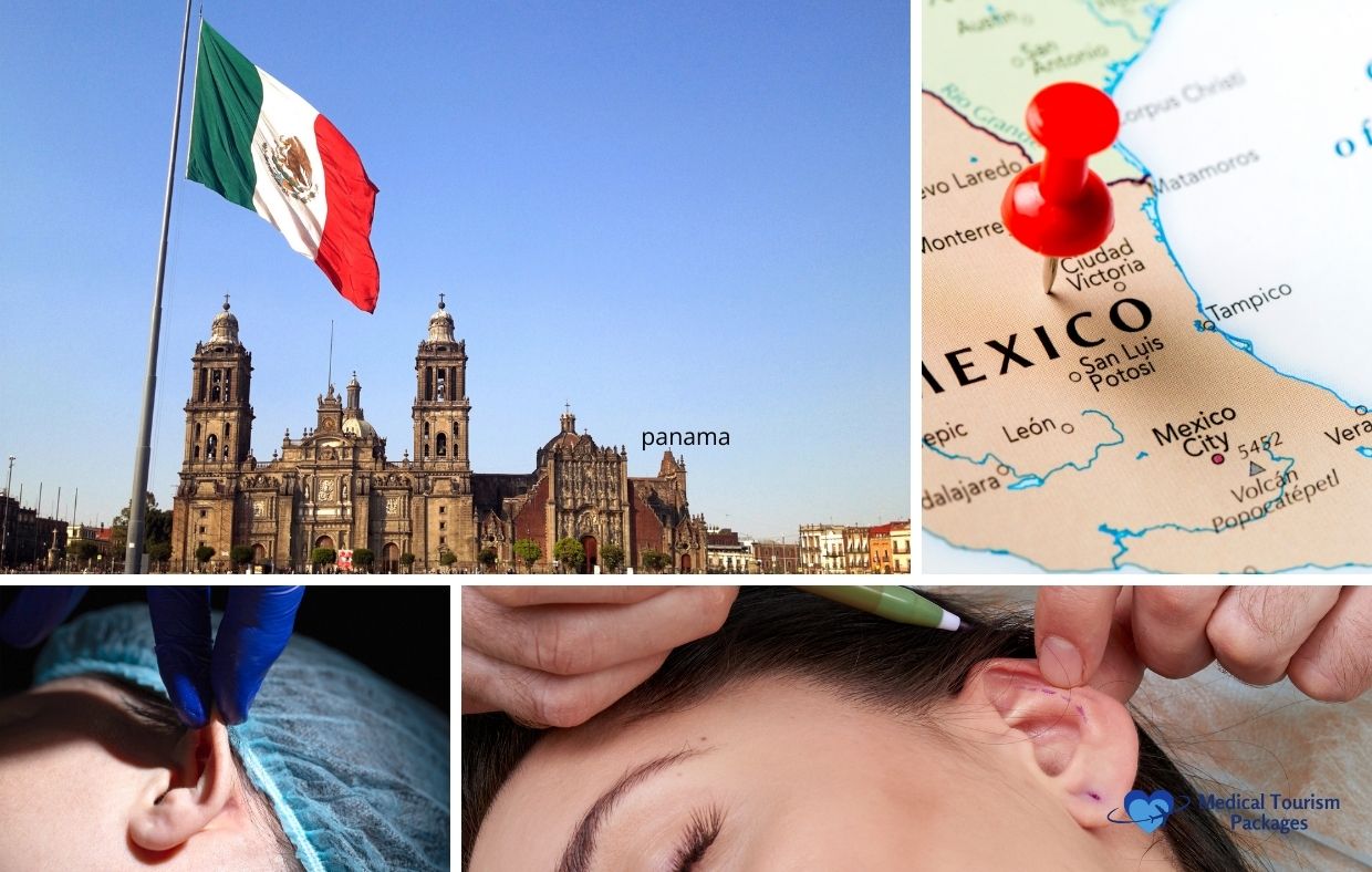 Collage que muestra la bandera mexicana en una plaza de la ciudad, un mapa de México con un marcador rojo y primeros planos de procedimientos de cirugía de orejas, destacando por qué los turistas médicos eligen la otoplastia en México.