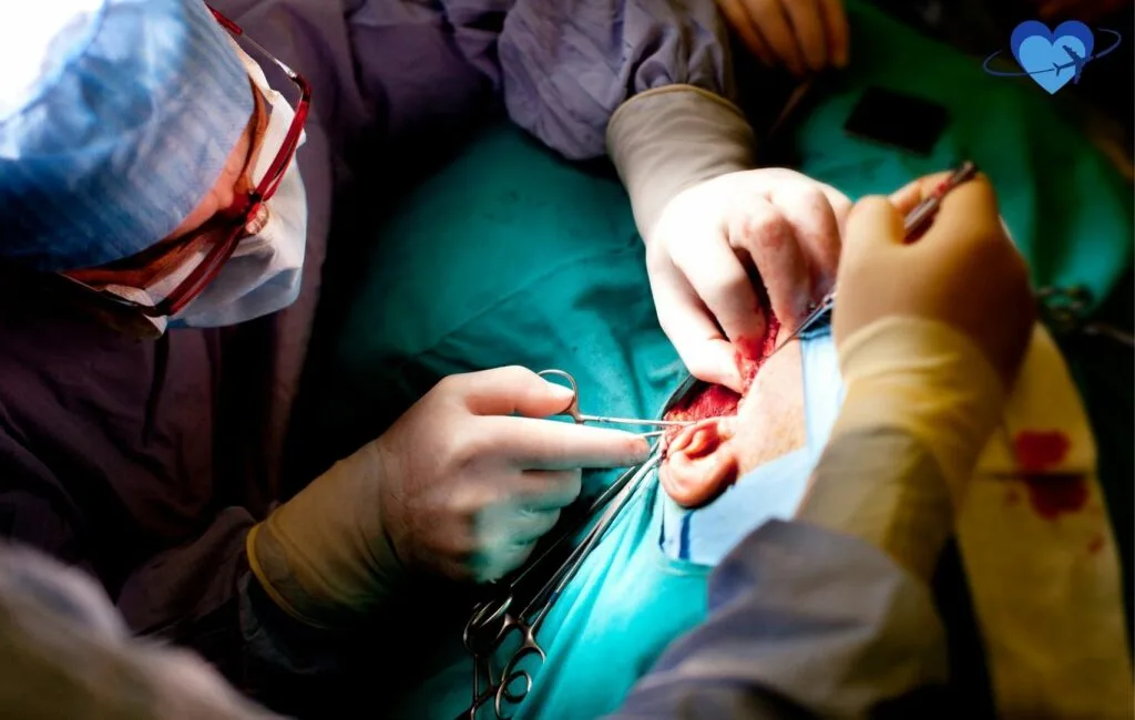 This image captures a live otoplasty (ear lift) surgery in Colombia, showcasing the precision and expertise involved in reshaping and repositioning the ears. The procedure involves careful incisions, cartilage reshaping, and suturing to achieve a balanced, natural look. Ear lifts (aka otoplasty) in Colombia are performed by highly skilled surgeons using advanced techniques to enhance ear symmetry and proportion. With top-tier medical facilities, affordable pricing, and excellent post-operative care, Colombia is a leading destination for those seeking high-quality otoplasty procedures and long-lasting results.