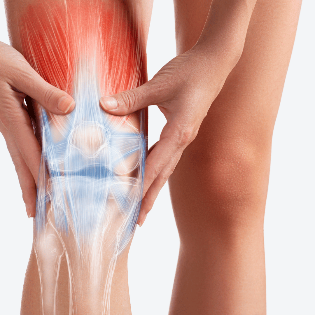 Persona que sujeta su rodilla con una superposición de tendones y músculos resaltados, lo que indica un posible enfoque en el dolor articular o muscular.