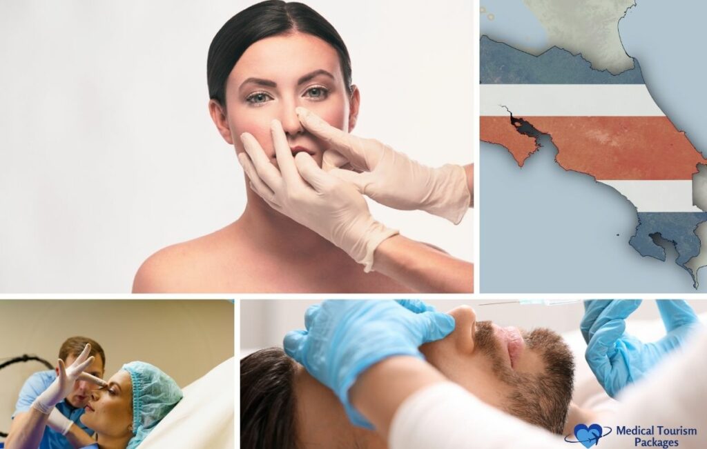 Un médico examina la nariz de una mujer, un mapa de Costa Rica y dos procedimientos de rinoplastia, con un logotipo de "Medical Tourism Packages" en la esquina, destacando cirujanos expertos en rinoplastia en Costa Rica.