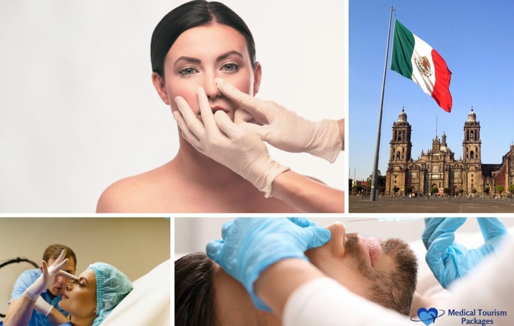 Collage showing rhinoplasty consultations and procedures, a Mexican flag, and a historical building, representing medical tourism and highlighting affordable rhinoplasty costs for a nose job in Mexico.