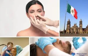 Collage showing rhinoplasty consultations and procedures, a Mexican flag, and a historical building, representing medical tourism and highlighting affordable rhinoplasty costs for a nose job in Mexico.