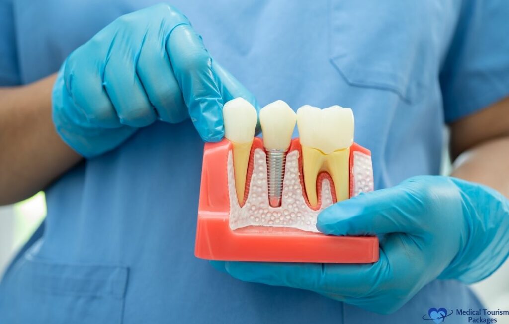 A person wearing blue gloves holds a dental model showing a dental implant between two natural teeth and points to it, highlighting the benefits of World-Class Dental care and Affordable Dental options.