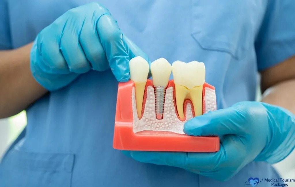 A person wearing blue gloves holds a dental model showing a dental implant between two natural teeth and points to it, highlighting the benefits of World-Class Dental care and Affordable Dental options.