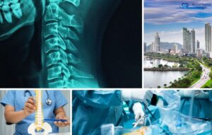 Collage showing a neck X-ray, city skyline, person holding a spine model, and surgeons performing a procedure, with a "Medical Tourism Packages" logo—highlighting Spine Surgery Panama and top hospitals in Panama.