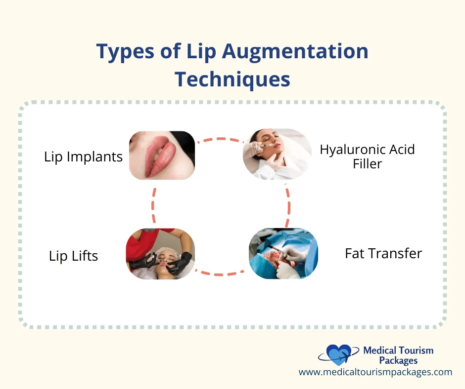 Esquema que muestra una guía completa de las técnicas de aumento de labios en Colombia: implantes labiales, relleno de ácido hialurónico, lifting labial y transferencia de grasa, cada una con sus imágenes correspondientes.
