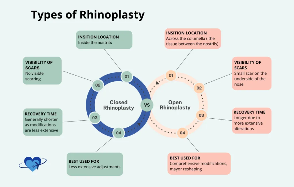 This image showcases the different types of rhinoplasty (nose job) in Colombia, including cosmetic, functional, and septoplasty procedures. Whether you're looking to enhance the shape of your nose, improve breathing, or correct structural issues, rhinoplasty in Colombia offers expert solutions tailored to your unique needs, all at an affordable cost with high-quality results.