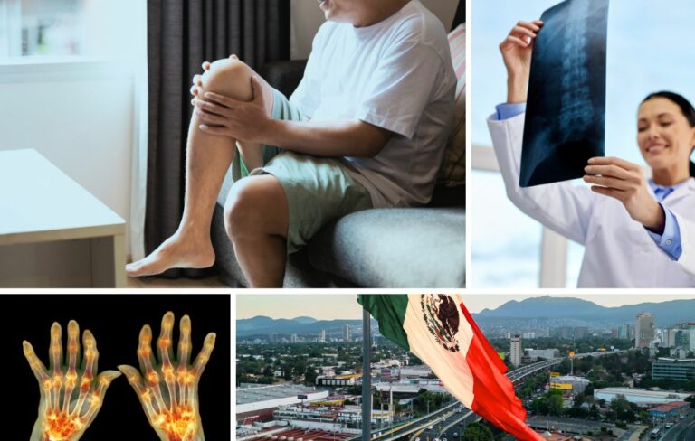 Un collage que muestra a una persona sujetándose la rodilla con dolor, un médico examinando una radiografía, articulaciones inflamadas en las manos y un paisaje urbano con una bandera mexicana, destacando a Rheumatology Surgery Mexico como una opción para los turistas médicos que buscan los mejores hospitales.