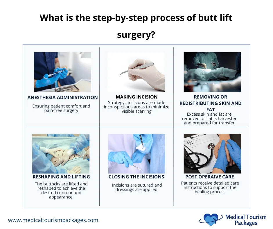 Six-panel surgical process diagram showing step-by-step butt lift procedure phases: anesthesia administration, incision making, fat redistribution, reshaping, closure, and post-operative care, each with descriptive text and medical photographs.