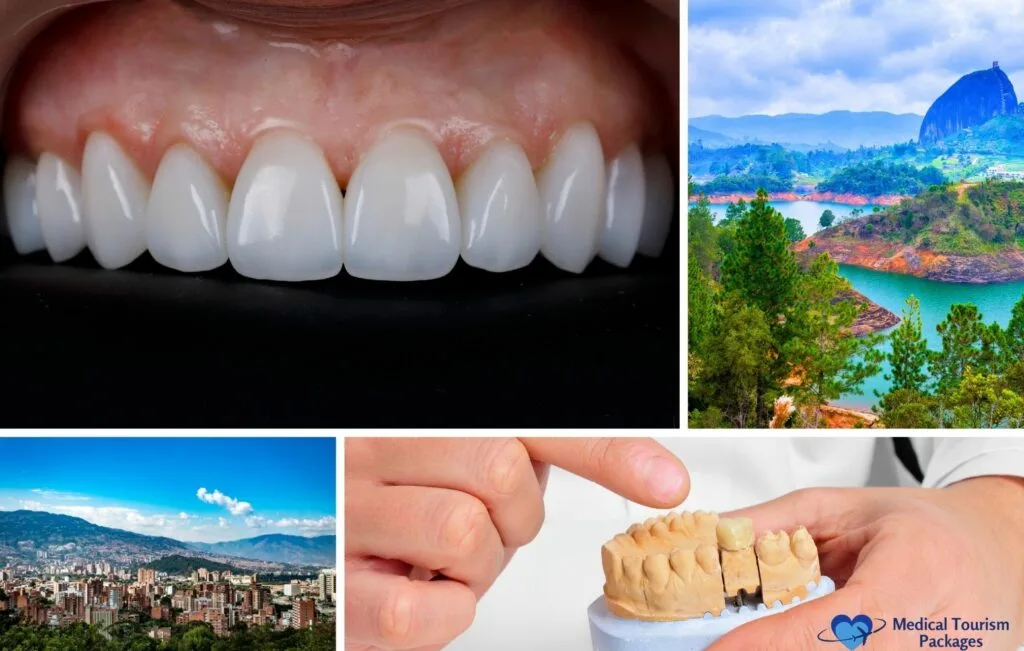 Un collage con carillas dentales, un modelo dental, montañas y aguas colombianas, además de un paisaje urbano, con el logotipo de "Medical Tourism Packages" en la esquina inferior derecha: una guía para la atención dental en Colombia.
