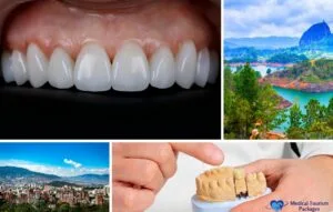 A collage features dental veneers, a dental model, scenic Colombian mountains and water, plus a cityscape, with a "Medical Tourism Packages" logo in the bottom right corner—a guide to dental care in Colombia.